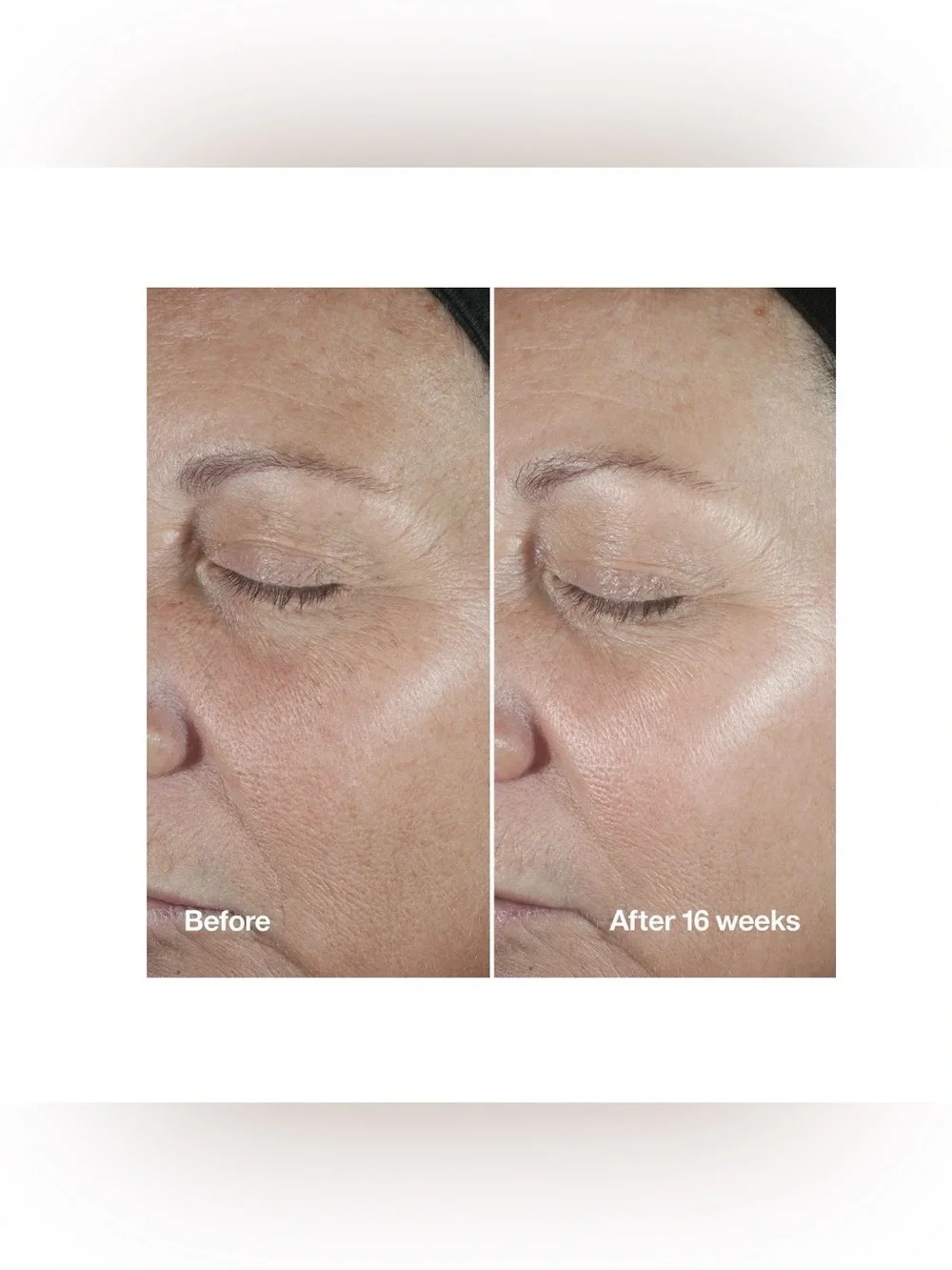 Clinique Smart Clinical Repair Wrinkle Correcting Serum